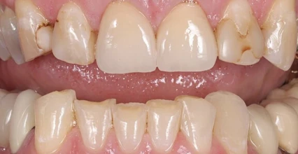 Before Image