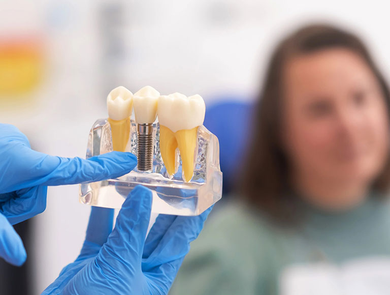 Dental Implant