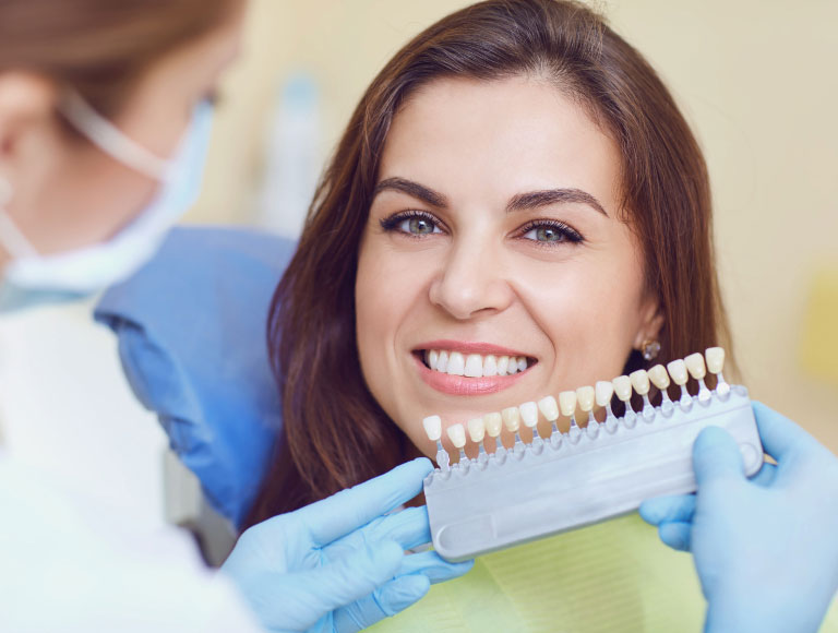 Dental Veneers